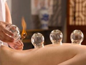 cupping